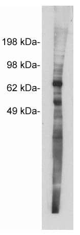 Western Blot: Netrin-1 Antibody [NBP3-30884] -  Western blot using Novus Biologicals' NBP3-30884, rabbit polyclonal at 5 ug/ml on MDCKII cell extract (10 ug/lane). Blots were developed with goat anti-rabbit Ig (1:100k) and Pierce’s Supersignal West Femto system.