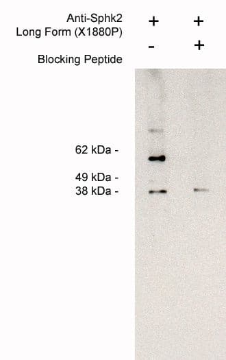 Western Blot: Sphingosine Kinase 2/SPHK2 Antibody [NBP3-30886] -  Western blot of endogenous sphingosine kinase 2 LF detection in Jurkat cell lysate (4 ug/lane) using NBP3-30886 (1 ug/ml) developed using anti-rabbit HRp (1:75K) and Pierce Super Signal west Femto.