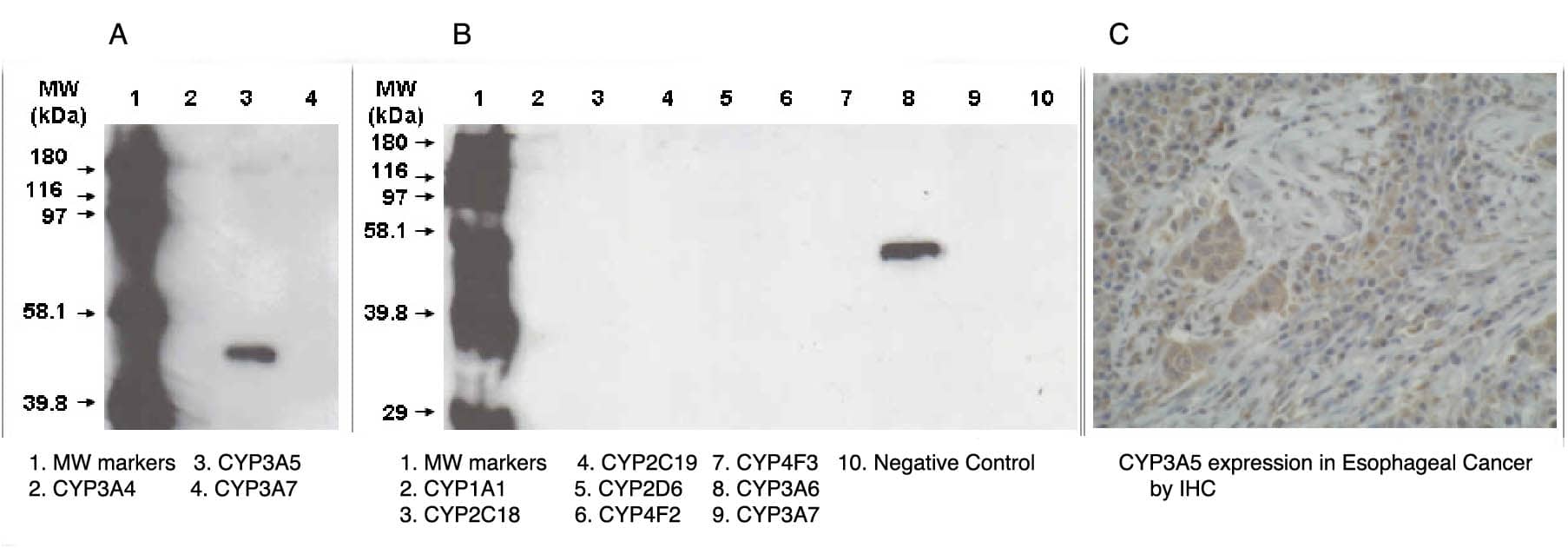 Immunohistochemistry: Cytochrome P450 3A5 Antibody (F18 P3 B6) [NBP3-30887] -  A. and B. Western blot using 3A5 antibody (Cat. No. NBP3-30887) on recombinant CYP450 proteins.C. Immunohistochemistry stain using 3A5 antibody on oesophagus cancer tissue.