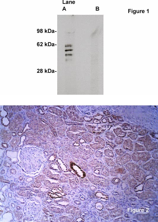 Western Blot: Sphingomyelin Synthase 2 Antibody [NBP3-30889] -  Fig 1. Western blot on human brain lysate (10 ug/lane) using Novus Biologicals' NBP3-30889 antibody to Sphingomyelin Synthase 2 (0.5 ug/ml). Lane A] 1 ug/ml antibody alone, lane B] antibody plus 3 ug blocking peptide. Blot was developed with Pierce’s Super System West Femto - 1 minute exposure. Fig 2. Human kidney section stained with Novus Biologicals' anti-SMS-2 antibody (Cat NBP3-30889) at 2 ug/ml. Anti-rabbit Ig H+L HRP conjugate (5 ug/ml) without antigen retrieval.