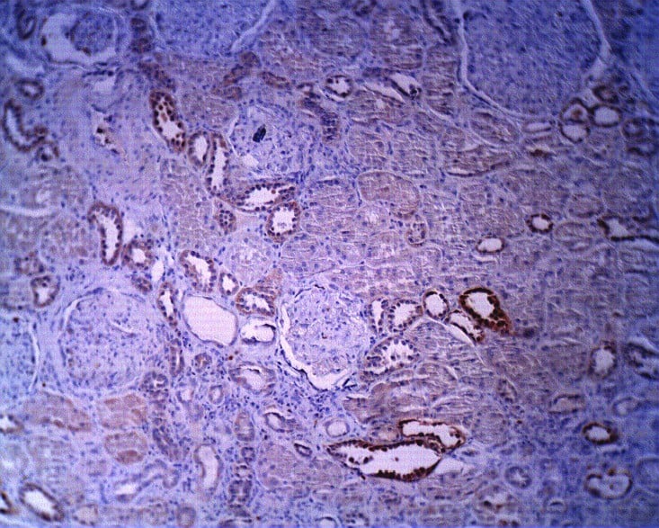 Immunohistochemistry-Paraffin Sphingomyelin synthase 1 Antibody - BSA Free