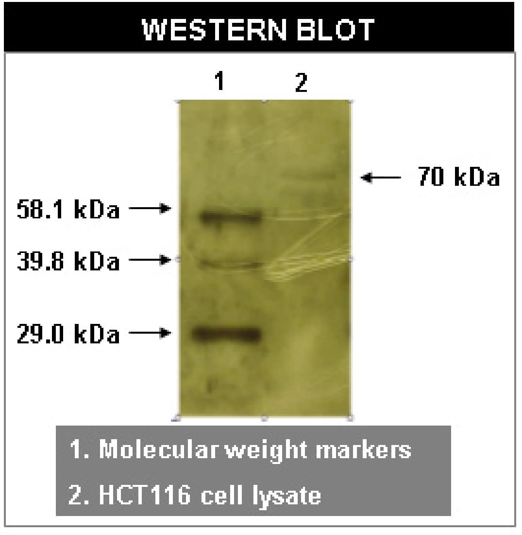 Western Blot: Ryk Antibody (F35 P7 D7 F5) [NBP3-30896] -  Western blot using RYK antibody (Cat. No. NBP3-30896) on HCT116 cell lysates.