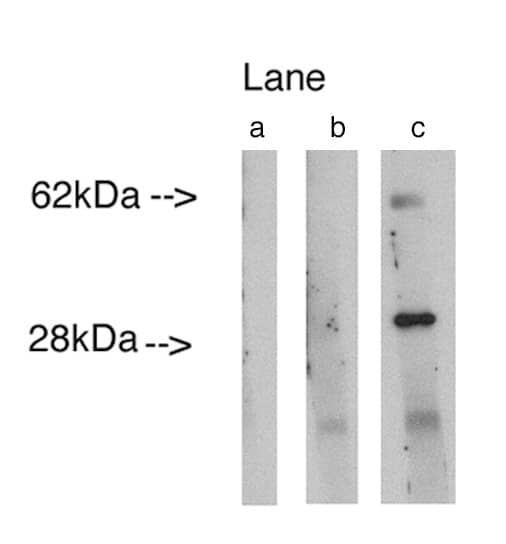 Western Blot: LASS4 Antibody [NBP3-30904] -  Western blot analysis using LAG1 longevity assurance homolog 4 (Cat.# NBP3-30904) at 0.75ug/ml on human lung lysate14 ug/lane. Lane A] conjugate alone, Lane B] antibody plus 27 ug blocking peptide, Lane C] antibody alone. Visualized using Pierce West Femto substrate system. Anti Rabbit secondary used at 1:3.5K dilution. Exposure for 5 minutes.