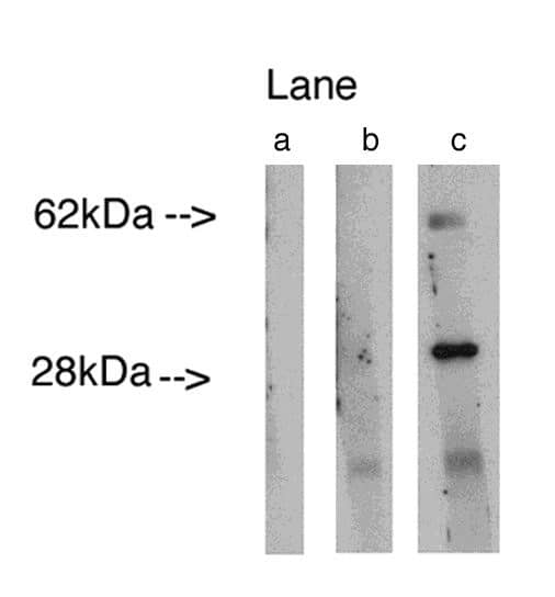 Western Blot: LASS4 Antibody [NBP3-30905] -  Western blot analysis using LAG1 longevity assurance homolog 4at 0.75ug/ml on human lung lysate14 ug/lane. Lane A] conjugate alone, Lane B] antibody plus 27 ug blocking peptide, Lane C] antibody alone. Visualized using Pierce West Femto substrate system. Anti Rabbit secondary used at 1:3.5K dilution. Exposure for 5 minutes.