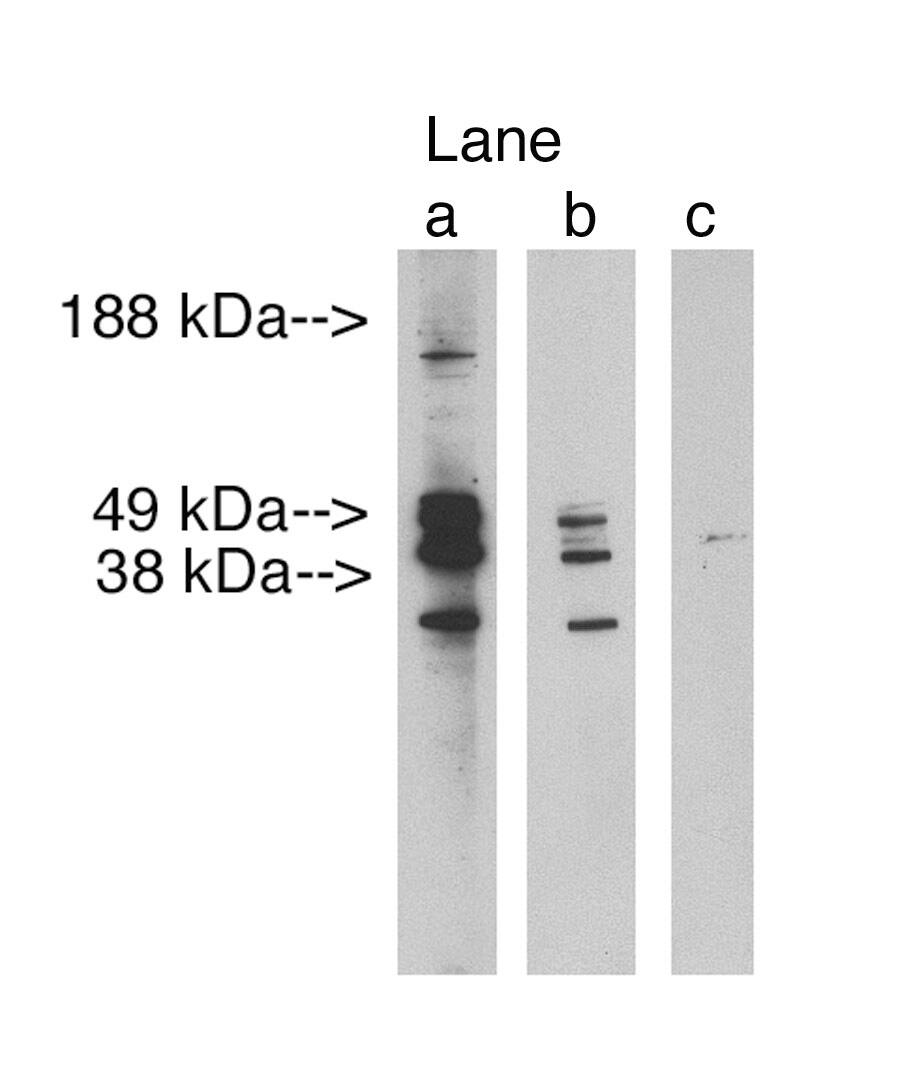 Western Blot: LASS3 Antibody [NBP3-30908] -  Western blot analysis using LAG1 longevity assurance homolog 3(Cat. NBP3-30908) at 2.5 ug/ml on human testis lysate 14 ug/lane. Lane A] antibody alone, Lane B] antibody blocked with 40 ug blocking peptide. Lane C] conjugate alone. Visualized using Pierce West Femto substrate system. Anti Rabbit secondary used at dilution used 1:3.5K. Exposure for 3 minutes.