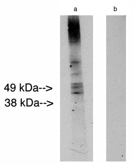 Western Blot: LASS2 Antibody [NBP3-30909] -  Western blot analysis using LAG1 longevity assurance homolog 2 (Cat. # NBP3-30909) at 10ug/ml on human placenta lysate 14 ug/lane. Lane A] antibody alone, Lane B] conjugate alone. Visualized using Pierce West Femto substrate system. Anti Rabbit secondary used at 1:10K dilution. Exposure for 5 minutes