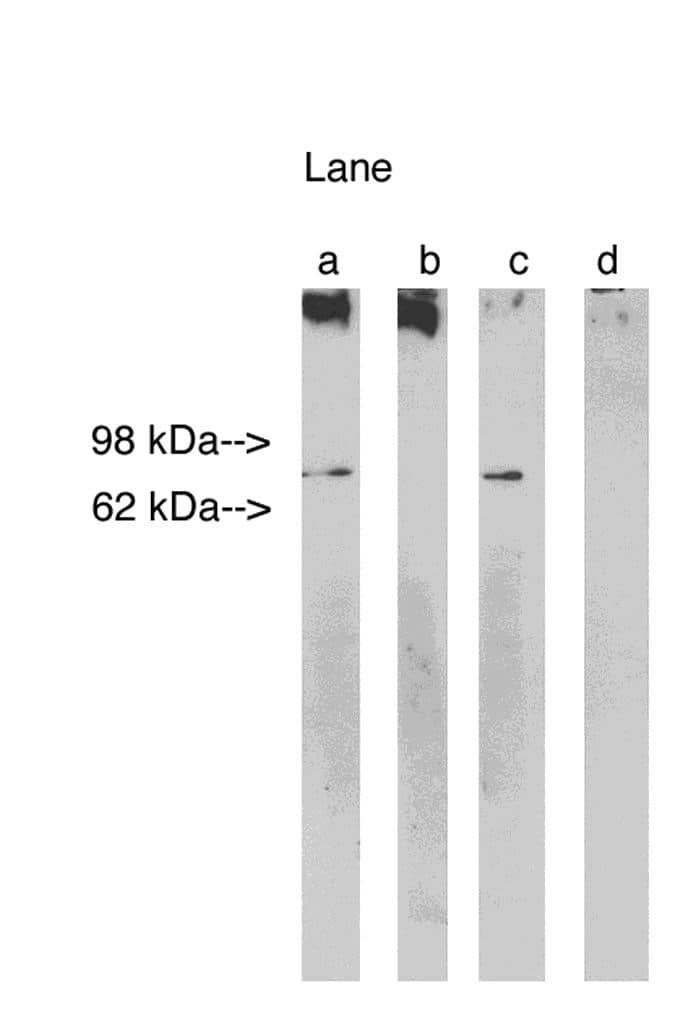 Western Blot LASS1 Antibody