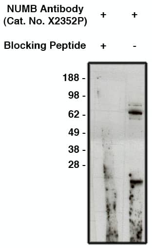 Western Blot: Numb Antibody [NBP3-30927] -  Western blot using anti-Numb antibody (Cat. No. NBP3-30927) on human brain lysate (14ug/lane). Antibody was used with (lane 1) and without (lane 2) blocking peptide at 10ug/ml.