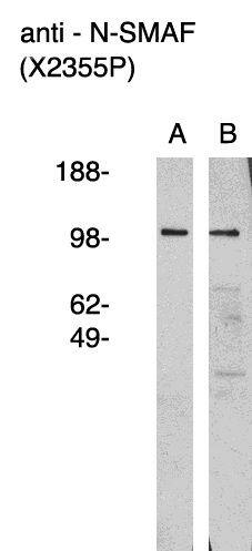 Western Blot: NSMAF Antibody [NBP3-30930] -  Western blot using anti nSMAF antibody (Cat. No. NBP3-30930) on human brain lysate (A) and RMS-13 rhabdosarcoma cell lysate (B). Lysate used at 15 ug/lane. Antibody used at 1:400 dilution. Secondary antibody, mouse anti-rabbit HRP , used at 1:50k dilution. Visualized using Pierce West Femto substrate system. Exposure for 5 minutes