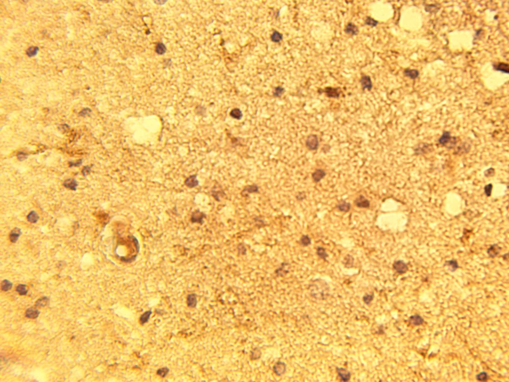 Immunohistochemistry: P2Y13/P2RY13/GPR86 Antibody [NBP3-30937] -  Immunohistochemical staining of normal human brain tissue using P2Y13 antibody (Cat. No. NBP3-30937) at 15 ug/ml