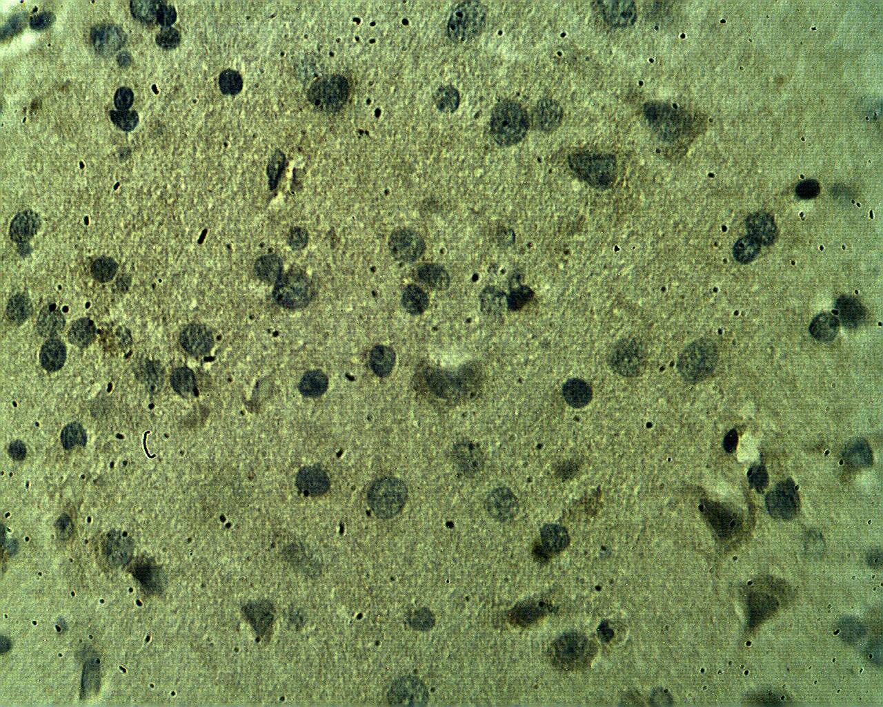 Immunohistochemistry: CSP Antibody [NBP3-30943] -  Immunohistochemical staining of human brain tissue using CSP alpha antibody at 10 ug/ml.