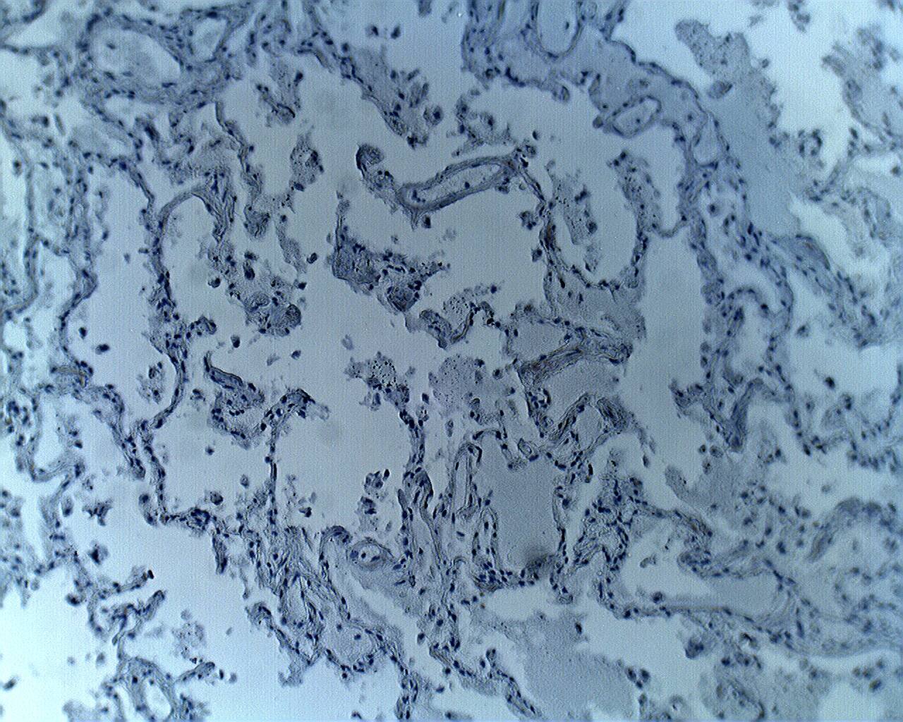 Immunohistochemistry: Aprataxin Antibody [NBP3-30946] -  Immunohistochemical staining of human lung tissue using Aprataxin antibody at 5 ug/ml