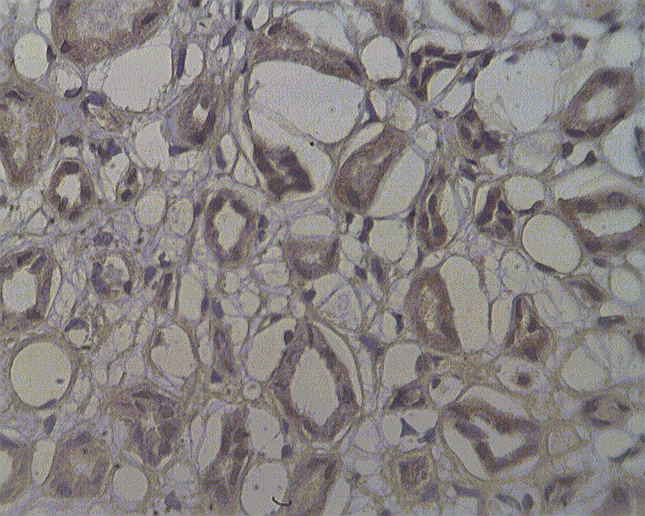 Immunohistochemistry-Paraffin: NOL4 Antibody [NBP3-30949] -  Staining on paraffin embedded normal human kidney sections using NOL4 antibody (Cat. No. NBP3-30949) at 10 ug/ml. Antigen retrieval used: 10 mM Na Citrate pH 6.0, 10 minutes pressure cooker method, developed with anti rabbit HRP and DAP substrate. Counterstained with methyl blue.