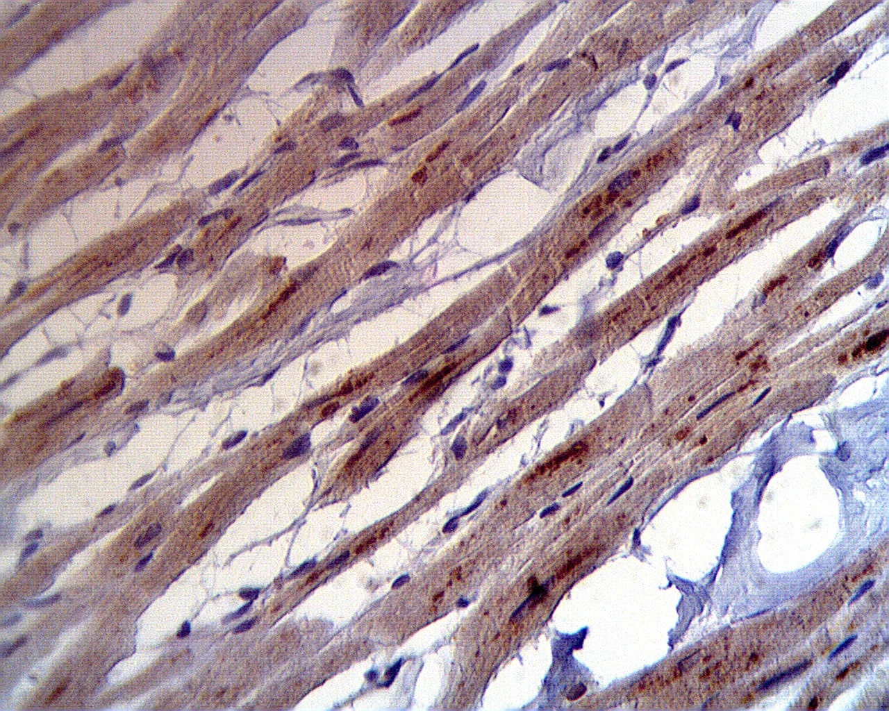 Immunohistochemistry: ASAH1 Antibody [NBP3-30951] -  Immunohistochemical staining of human heart tissue using ASAH1 antibody at 10 ug/ml.