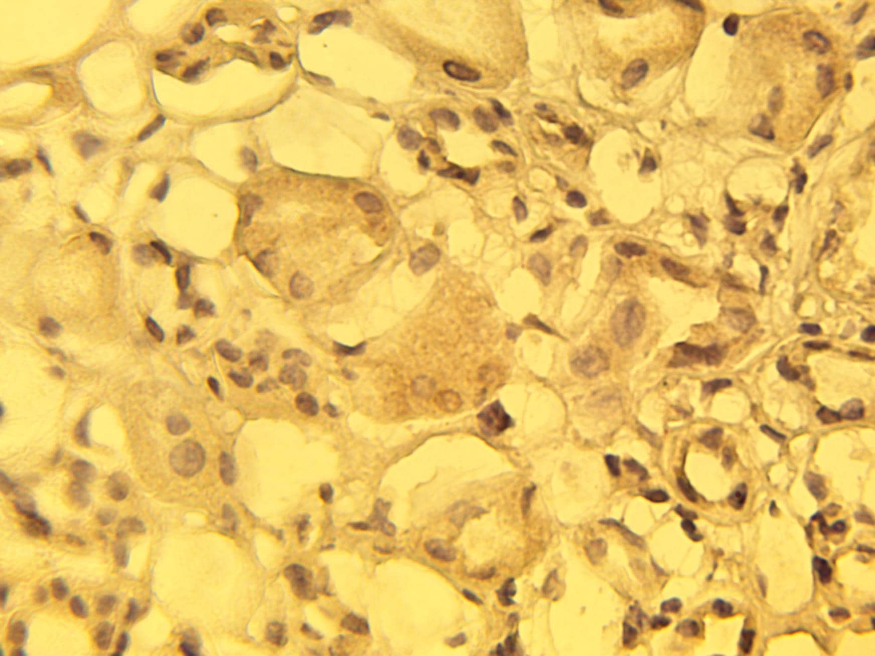 Immunohistochemistry: CACNA1A Antibody [NBP3-30953] -  Immunohistochemical staining of normal human kidney tissue with alpha1C calcium channel antibody (Cat. No. NBP3-30953) at 15 ug/ml