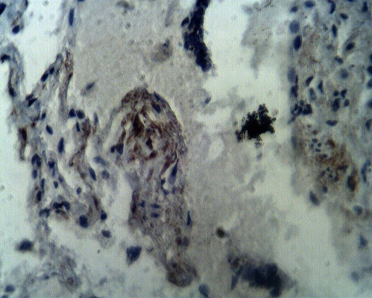 Immunohistochemistry: Aprataxin Antibody [NBP3-30957] -  Immunohistochemical staining of normal human lung tissue using Aprataxin antibody (Cat. No. NBP3-30957) at 10 ug/ml.