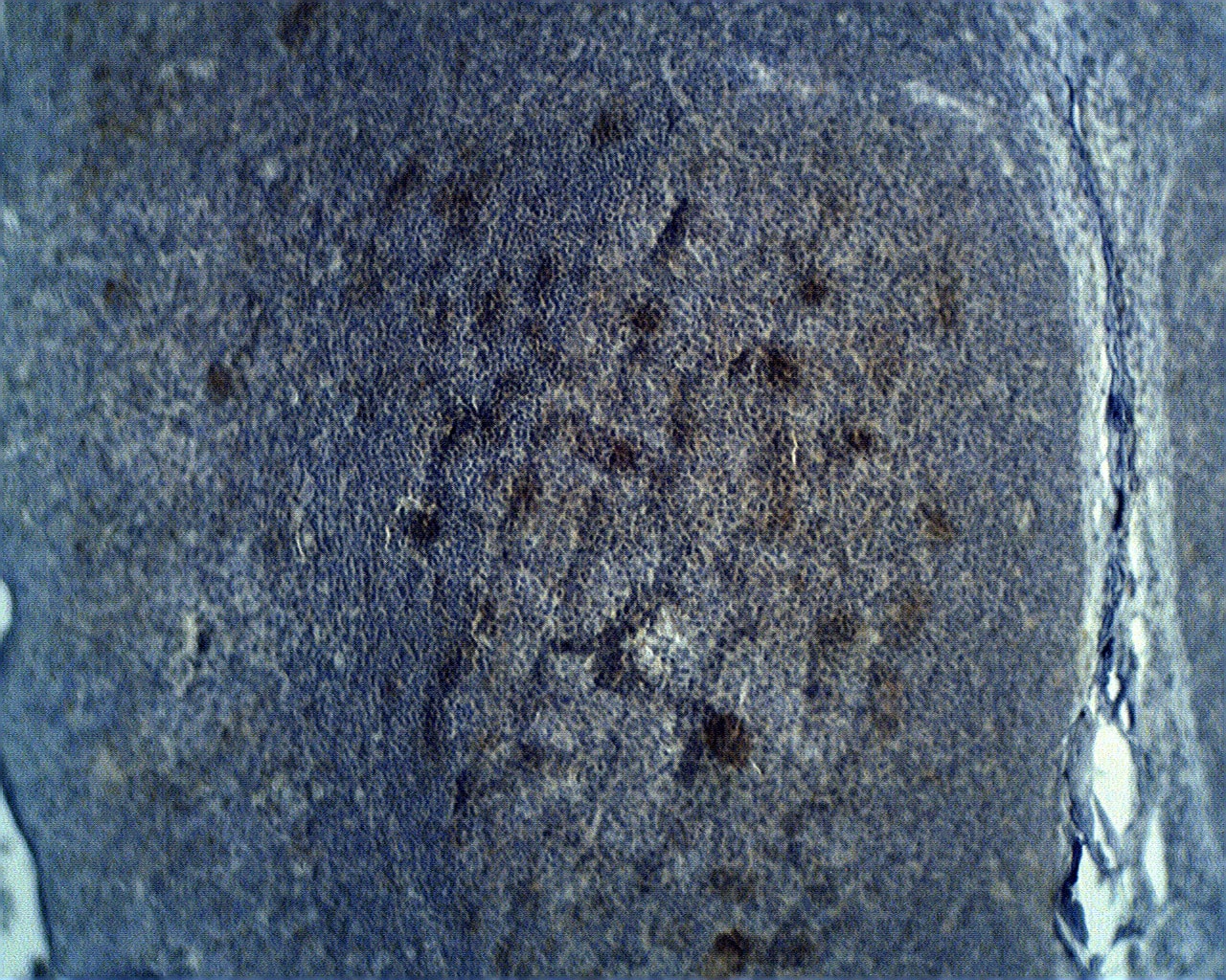 Immunohistochemistry ADAMDEC1 Antibody - BSA Free