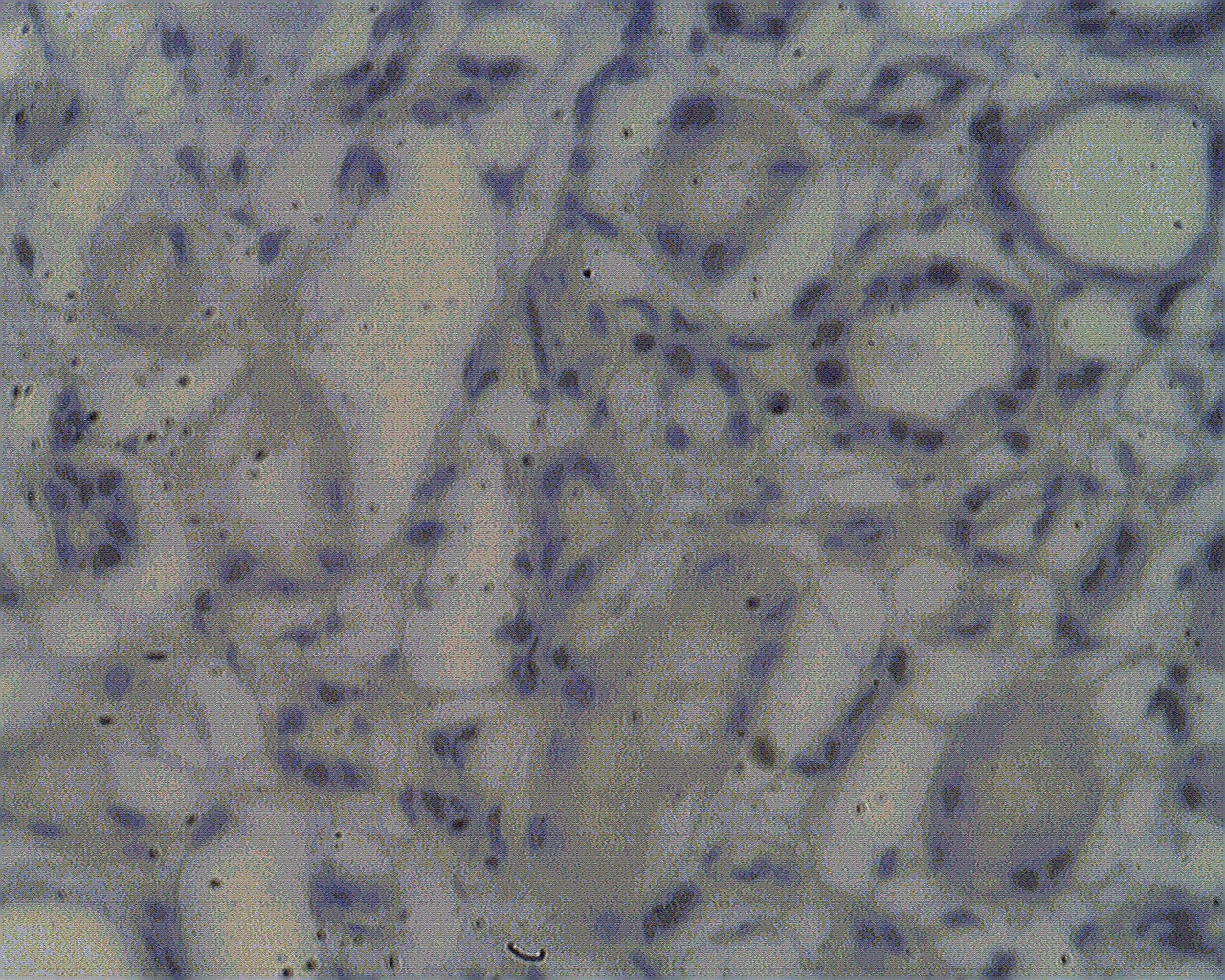 Immunohistochemistry-Paraffin: NOL4 Antibody [NBP3-30960] -  Staining on paraffin embedded normal human kidney sections using NOL4 antibody (Cat. No. NBP3-30960) at 2 ug/ml. Antigen retrieval used: 10 mM Na Citrate pH 6.0, 10 minutes pressure cooker method, developed with anti rabbit HRP and DAP substrate. Counterstained with methyl blue.