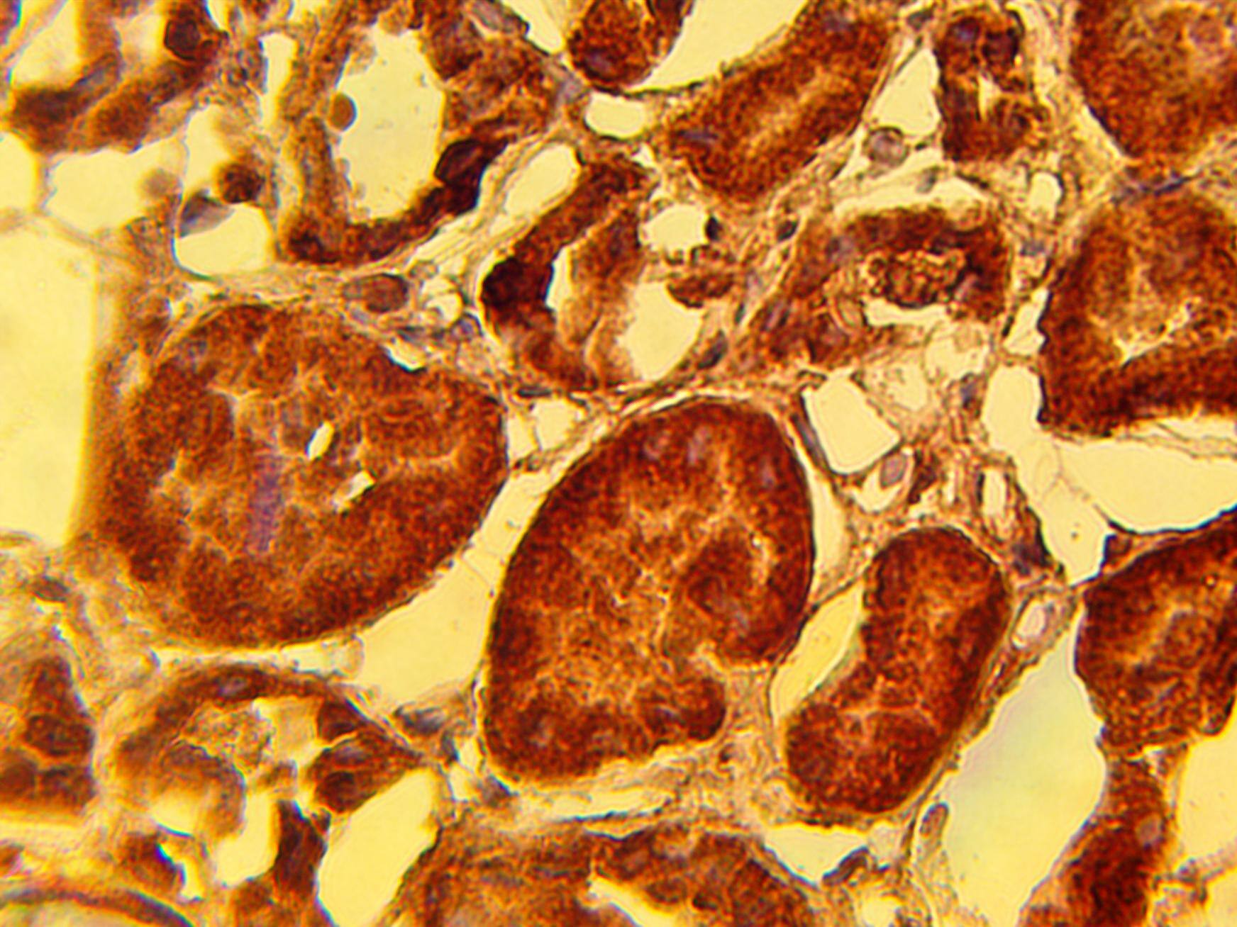 Immunohistochemistry: PHLPP2 Antibody [NBP3-30962] -  Immunohistochemical staining of normal human kidney tissue using PHLPP2 antibody (Cat. No. NBP3-30962) at 15 ug/ml and detected using anti-Rabbit HRP secondary antibody and visualized using DAB substrate and hematoxylin counterstain.