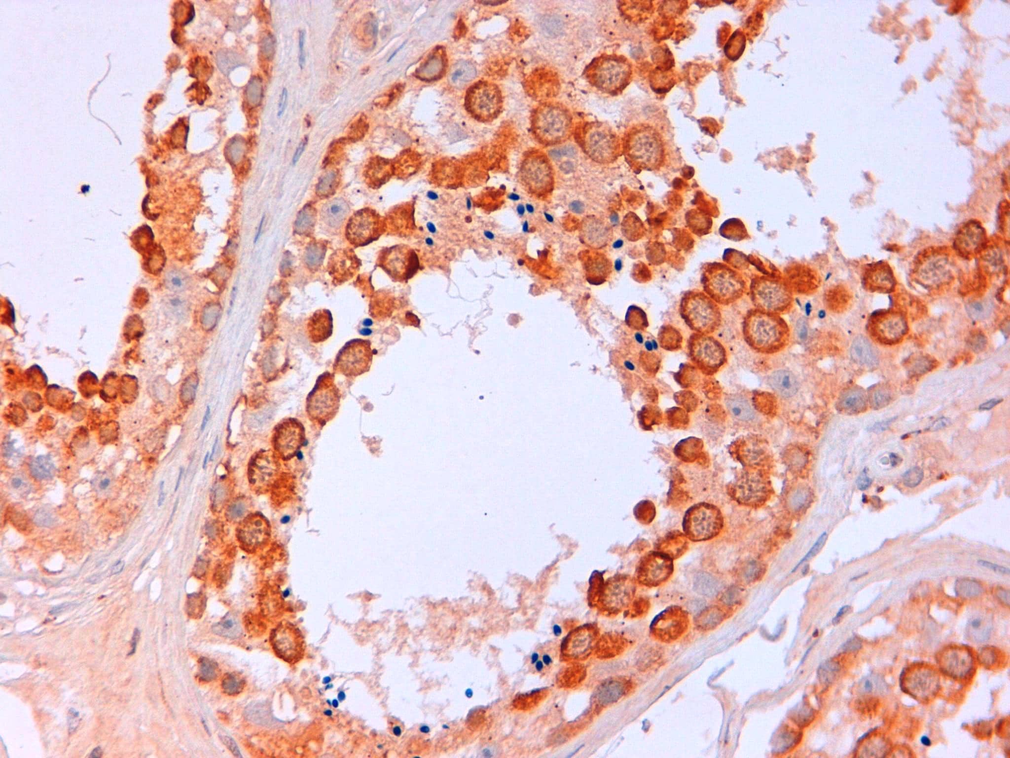 Immunohistochemistry-Paraffin: VASA Antibody [NBP3-30963] -  Immunohistochemical staining of FFPE human testis using DDX antibody at 5 ug/ml visualized using goat anti-rabbit-HRP secondary and DAB substrate at pH 6.2. Pathologist comment: Very good staining on germ cell testicular @ pH6.2, little background on tissue.