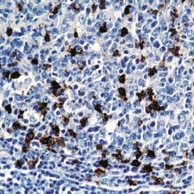 Immunohistochemistry: beta-1,3-Glucuronyltransferase 1/B3GAT1 Antibody (NK-1) [NBP3-30967] -  Immunohistochemical staining of human tonsil using anti-beta-1,3-Glucuronyltransferase 1/B3GAT1, clone NK-1 (Cat. No. NBP3-30967)