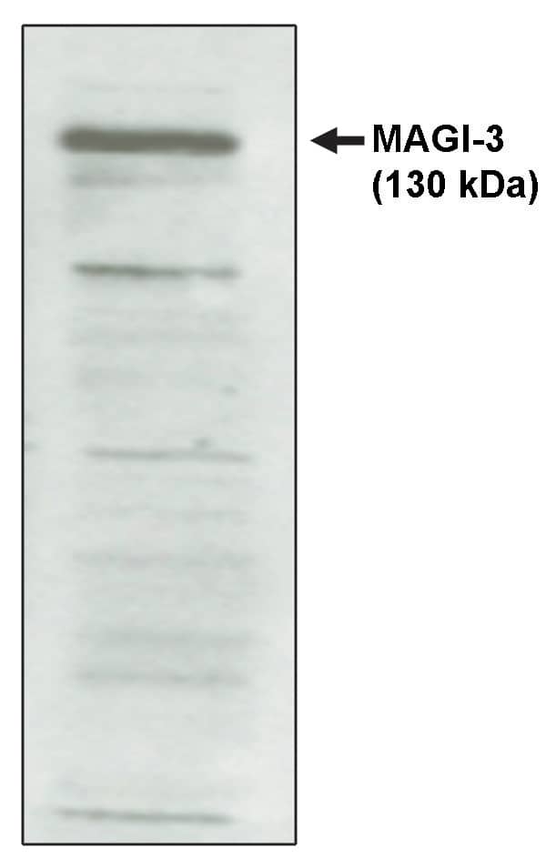 Western Blot: MAGI3 Antibody [NBP3-30984] -  Western blot analysis using MAGI-3, PDZ 4-5 antibody on cell lysates transfected with full-length human MAGI-3protein.