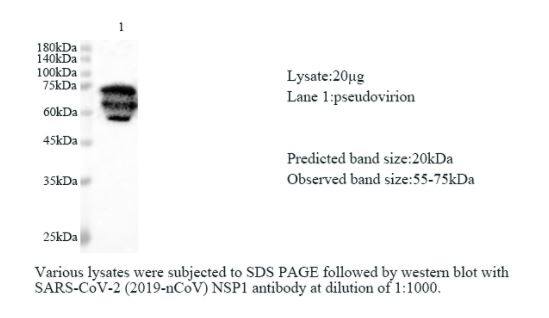 Various lysates were subjected to SDS-PAGE followed by western blot with SARS-CoV-2 nsp1 Antibody at dilution of 1:1000