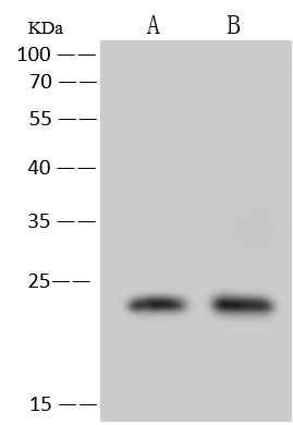 Western Blot: CINP Antibody [NBP3-31976] - NBP3-31976 at 1:500 dilution Lane A: Jurkat Whole Cell Lysate Lane B: HeLa Whole Cell Lysate Lysates/proteins at 30 ug per lane. Secondary Goat Anti-Rabbit IgG (H+L)/HRP at 1/10000 dilution. Developed using the ECL technique. Performed under reducing conditions. Predicted band size:24 kDa Observed band size:24 kDa 