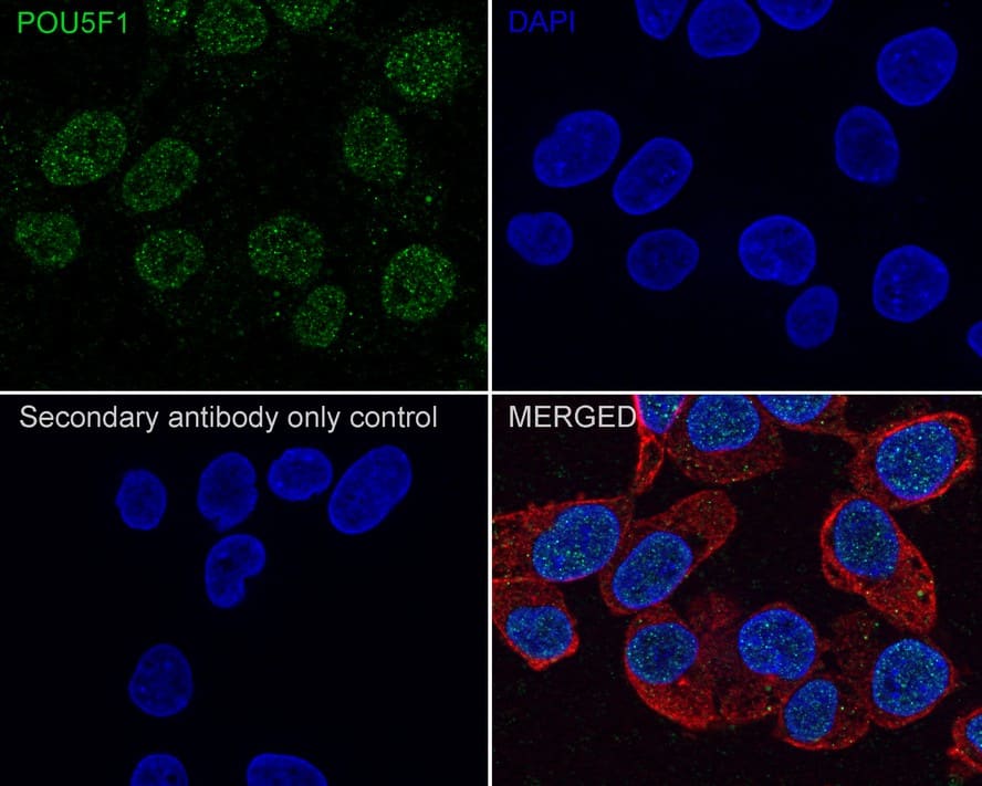 Immunocytochemistry/ Immunofluorescence: OCT4 Antibody (A3-C11-R) [NBP3-31983] - Immunocytochemistry analysis of NCCIT cells labeling OCT4 with Mouse anti-OCT4 antibody (NBP3-31983) at 1/100 dilution. Cells were fixed in 4% paraformaldehyde for 20 minutes at room temperature, permeabilized with 0.1% Triton X-100 in PBS for 5 minutes at room temperature, then blocked with 1% BSA in 10% negative goat serum for 1 hour at room temperature. Cells were then incubated with Mouse anti-OCT4 antibody (NBP3-31983) at 1/100 dilution in 1% BSA in PBST overnight at 4 ℃. Goat Anti-Mouse IgG H&L (iFluor™ 488) was used as the secondary antibody at 1/1,000 dilution. PBS instead of the primary antibody was used as the secondary antibody only control. Nuclear DNA was labelled in blue with DAPI. beta Tubulin (red) was stained at 1/100 dilution overnight at +4℃. Goat Anti-Rabbit IgG H&L (iFluor™ 594) were used as the secondary antibody at 1/1,000 dilution.