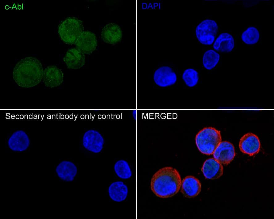 Immunocytochemistry/ Immunofluorescence: c-Abl Antibody (PSH04-08) [NBP3-31990] - Immunocytochemistry analysis of K-562 cells labeling c-Abl with Rabbit anti-c-Abl antibody (NBP3-31990) at 1/100 dilution. Cells were fixed in 4% paraformaldehyde for 20 minutes at room temperature, permeabilized with 0.1% Triton X-100 in PBS for 5 minutes at room temperature, then blocked with 1% BSA in 10% negative goat serum for 1 hour at room temperature. Cells were then incubated with Rabbit anti-c-Abl antibody (NBP3-31990) at 1/100 dilution in 1% BSA in PBST overnight at 4 ℃. Goat Anti-Rabbit IgG H&L (iFluor™ 488) was used as the secondary antibody at 1/1,000 dilution. PBS instead of the primary antibody was used as the secondary antibody only control. Nuclear DNA was labelled in blue with DAPI. Beta tubulin (red) was stained at 1/100 dilution overnight at +4℃. Goat Anti-Mouse IgG H&L (iFluor™ 594) was used as the secondary antibody at 1/1,000 dilution.