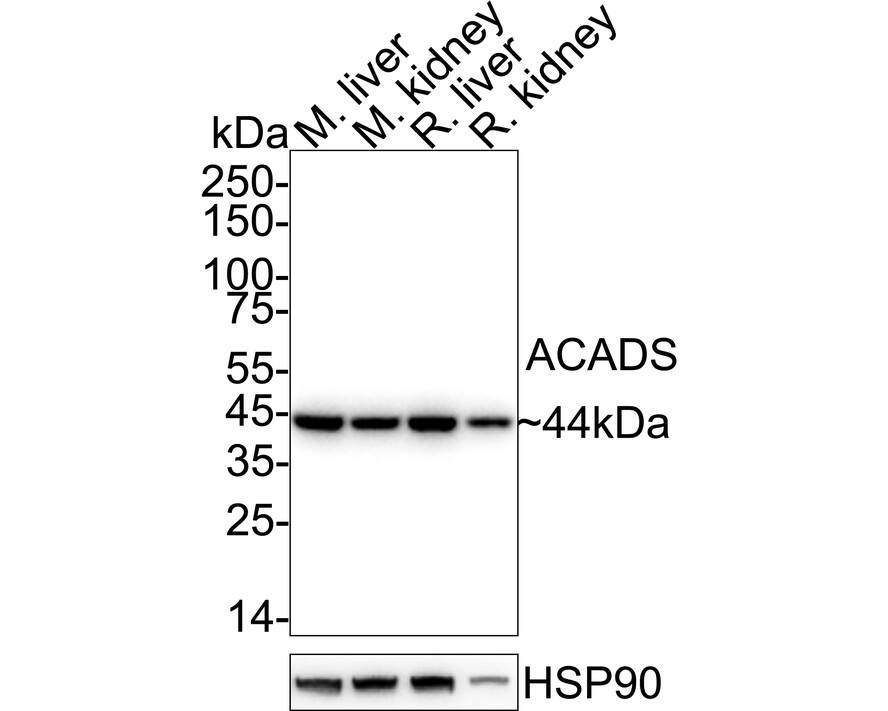 Western blot analysis on different lysates with NBP3-31991 at 1/2,000 dilution. Lane 1: Mouse liver tissue lysate Lane 2: Mouse kidney tissue lysate Lane 3: Rat liver tissue lysate Lane 4: Rat kidney tissue lysate Lysates/proteins at 40 µg/Lane. Predicted band size: 44 kDa Observed band size: 44 kDa Exposure time: 10 seconds;  4-20% SDS-PAGE gel. Proteins were transferred to a PVDF membrane and blocked with 5% NFDM/TBST for 1 hour at room temperature. NBP3-31991 at 1/2,000 dilution was used in 5% NFDM/TBST at 4℃ overnight. Goat Anti-Rabbit IgG [HRP] Secondary Antibody at 1/50,000 dilution was used for 1 hour at room temperature.