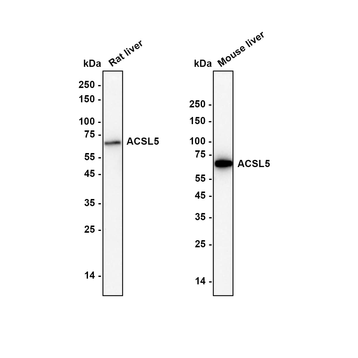 Western blot analysis on different lysates with NBP3-31995 at 1/2,000 dilution. Lane 1: Mouse liver tissue lysate Lane 2: Rat liver tissue lysate Lysates/proteins at 10 µg/Lane. Exposure time: 1 minute 17 seconds Blocking: 5% NFDM/TBST, 1 hour at room temperature Primary antibody: NBP3-31995, 1/2,000 in primary antibody dilution buffer, overnight at 4 ℃ Secondary antibody: Goat anti-Mouse IgG [HRP], 1/50,000 in 5% NFDM/TBST, 1 hour at room temperature Predicted band size: 76 kDa Observed band size: 70 kDa