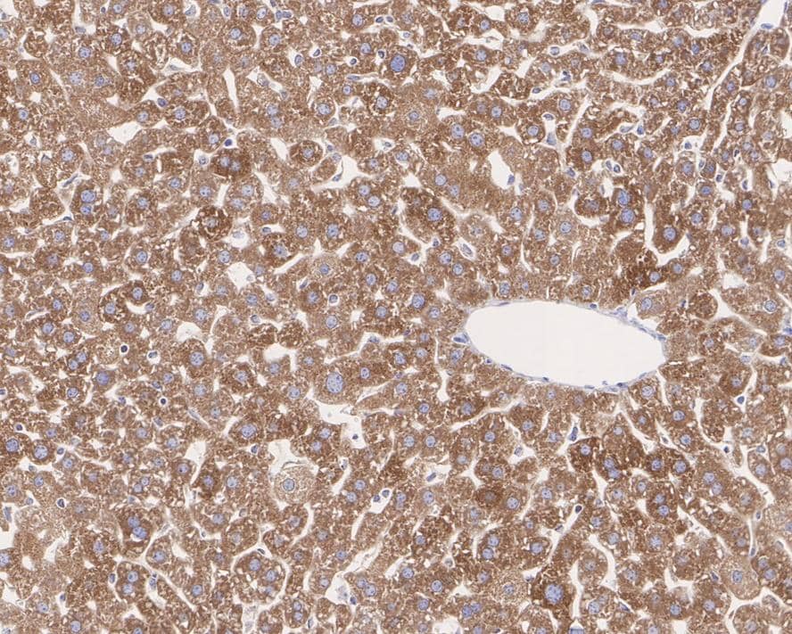 Immunohistochemistry: ACSL5 Antibody (A9D4-R) [NBP3-31995] - Immunohistochemical analysis of paraffin-embedded mouse liver tissue with Mouse anti-ACSL5 antibody (NBP3-31995) at 1/1,000 dilution. The section was pre-treated using heat mediated antigen retrieval with Tris-EDTA buffer (pH 9.0) for 20 minutes. The tissues were blocked in 1% BSA for 20 minutes at room temperature, washed with ddH2O and PBS, and then probed with the primary antibody (NBP3-31995) at 1/1,000 dilution for 1 hour at room temperature. The detection was performed using an HRP conjugated compact polymer system. DAB was used as the chromogen. Tissues were counterstained with hematoxylin and mounted with DPX.