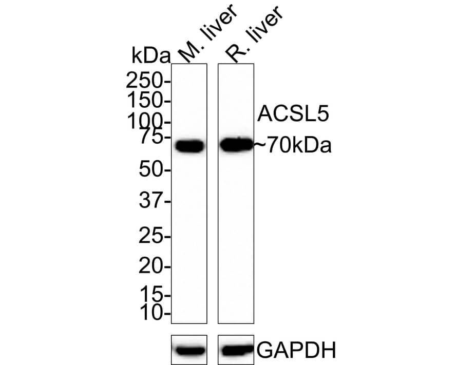 Western Blot: ACSL5 Antibody (A9D4-R) [NBP3-31995] - Western blot analysis of ACSL5 on different lysates with Mouse anti-ACSL5 antibody (NBP3-31995) at 1/1,000 dilution. Lane 1: Mouse liver tissue lysate Lane 2: Rat liver tissue lysate Lysates/proteins at 30 ug/Lane. Predicted band size: 76 kDa Observed band size: 70 kDa Exposure time: 3 minutes; 4-20% SDS-PAGE gel. Proteins were transferred to a PVDF membrane and blocked with 5% NFDM/TBST for 1 hour at room temperature. The primary antibody (NBP3-31995) at 1/1,000 dilution was used in 5% NFDM/TBST at room temperature for 2 hours. Goat Anti-Mouse IgG - HRP Secondary Antibody at 1:100,000 dilution was used for 1 hour at room temperature.