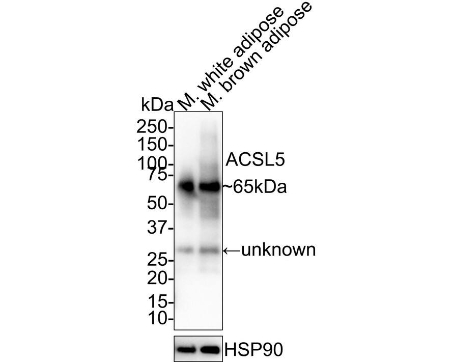 Western blot analysis on different lysates with NBP3-31996 at 1/1,000 dilution. Lane 1: Mouse white adipose tissue lysate Lane 2: Mouse brown adipose tissue lysate Lysates/proteins at 30 µg/Lane. Predicted band size: 76 kDa Observed band size: 65 kDa Exposure time: 24 seconds; 4-20% SDS-PAGE gel. Proteins were transferred to a PVDF membrane and blocked with 5% NFDM/TBST for 1 hour at room temperature. NBP3-31996 at 1/1,000 dilution was used in 5% NFDM/TBST at room temperature for 2 hours. Goat anti-Mouse IgG [HRP] at 1:50,000 dilution was used for 1 hour at room temperature.