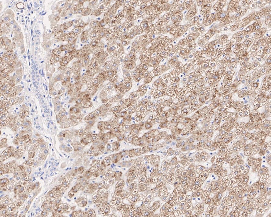 Immunohistochemistry: ACSL5 Antibody (A9D3-R) [NBP3-31996] - Immunohistochemical analysis of paraffin-embedded human liver tissue with Mouse anti-ACSL5 antibody (NBP3-31996) at 1/1,000 dilution. The section was pre-treated using heat mediated antigen retrieval with Tris-EDTA buffer (pH 9.0) for 20 minutes. The tissues were blocked in 1% BSA for 20 minutes at room temperature, washed with ddH2O and PBS, and then probed with the primary antibody (NBP3-31996) at 1/1,000 dilution for 1 hour at room temperature. The detection was performed using an HRP conjugated compact polymer system. DAB was used as the chromogen. Tissues were counterstained with hematoxylin and mounted with DPX.