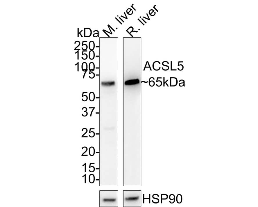 Western Blot: ACSL5 Antibody (A9D3-R) [NBP3-31996] - Western blot analysis of ACSL5 on different lysates with Mouse anti-ACSL5 antibody (NBP3-31996) at 1/1,000 dilution. Lane 1: Mouse liver tissue lysate Lane 2: Rat liver tissue lysate Lysates/proteins at 30 ug/Lane. Predicted band size: 76 kDa Observed band size: 65 kDa Exposure time: 1 minute; 4-20% SDS-PAGE gel. Proteins were transferred to a PVDF membrane and blocked with 5% NFDM/TBST for 1 hour at room temperature. The primary antibody (NBP3-31996) at 1/1,000 dilution was used in 5% NFDM/TBST at room temperature for 2 hours. Goat Anti-Mouse IgG - HRP Secondary Antibody at 1:100,000 dilution was used for 1 hour at room temperature.