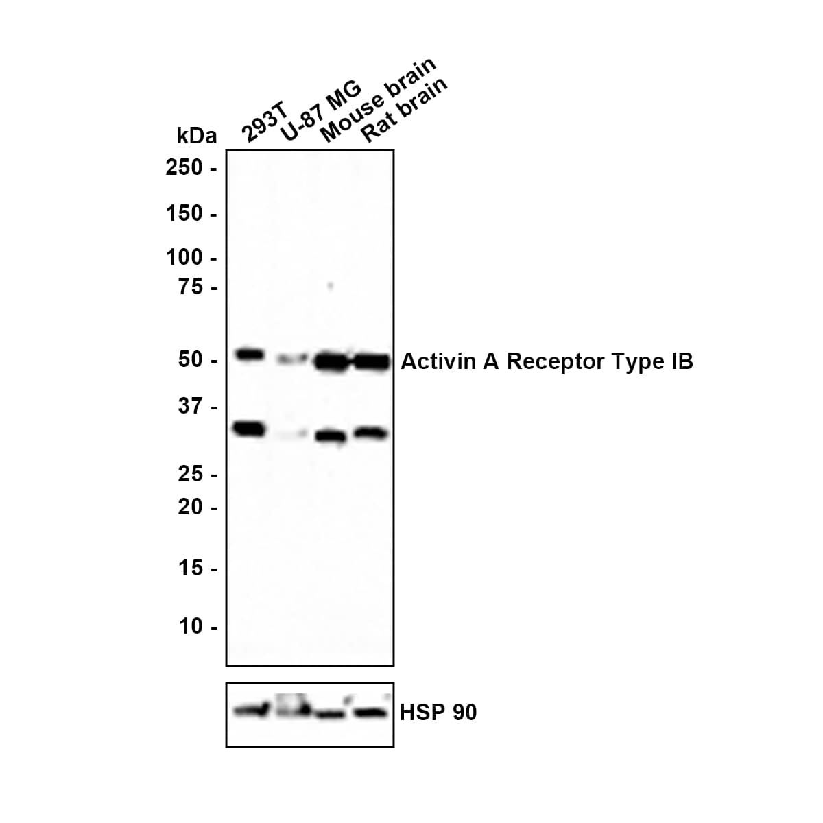 Western blot analysis on different lysates with NBP3-31998 at 1/1,000 dilution. Lane 1: 293T cell lysate (15 µg/Lane) Lane 2: U-87 MG cell lysate (20 µg/Lane) Lane 3: Mouse brain tissue lysate (20 µg/Lane) Lane 4: Rat brain tissue lysate (20 µg/Lane) Predicted band size: 57 kDa Observed band size: 52 kDa Exposure time: 3 minutes; 4-20% SDS-PAGE gel. Proteins were transferred to a PVDF membrane and blocked with 5% NFDM/TBST for 1 hour at room temperature. NBP3-31998 at 1/1,000 dilution was used in 5% NFDM/TBST at room temperature for 2 hours. Goat Anti-Rabbit IgG [HRP] Secondary Antibody at 1:100,000 dilution was used for 1 hour at room temperature.