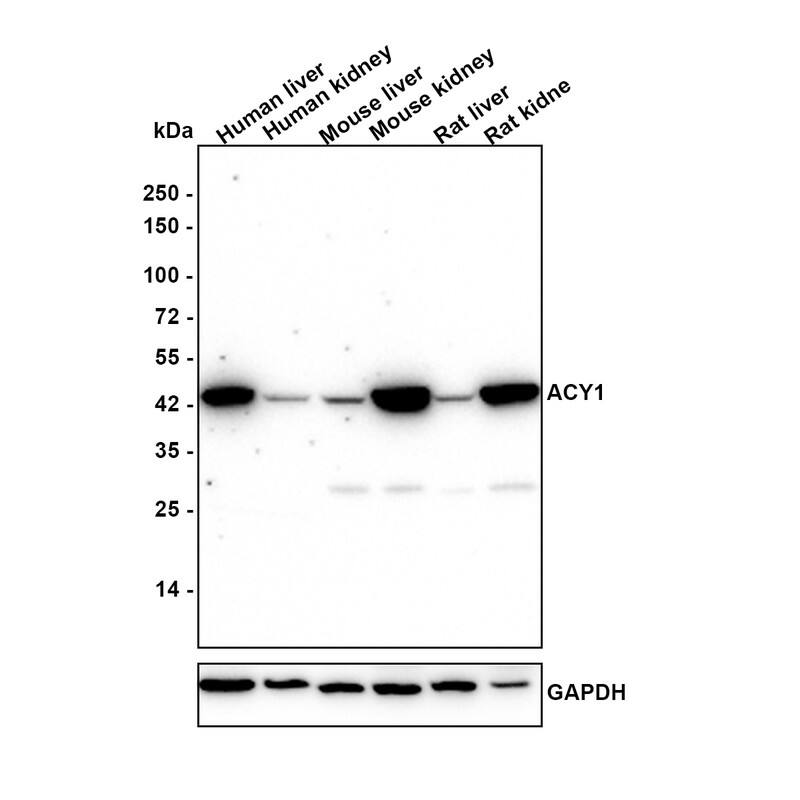 Western blot analysis on different lysates with NBP3-32000 at 1/1,000 dilution. Lane 1: K-562 cell lysate (20 µg/Lane) Lane 2: Human liver tissue lysate (40 µg/Lane) Lane 3: Human kidney tissue lysate (40 µg/Lane) Lane 4: Mouse liver tissue lysate (40 µg/Lane) Lane 5: Mouse kidney tissue lysate (40 µg/Lane) Lane 6: Rat liver tissue lysate (40 µg/Lane) Lane 7: Rat kidney tissue lysate (40 µg/Lane) Predicted band size: 46 kDa Observed band size: 42 kDa Exposure time: 3 minutes; 4-20% SDS-PAGE gel. Proteins were transferred to a PVDF membrane and blocked with 5% NFDM/TBST for 1 hour at room temperature. NBP3-32000 at 1/1,000 dilution was used in 5% NFDM/TBST at 4℃ overnight. Goat anti-Mouse IgG [HRP] at 1/50,000 dilution was used for 1 hour at room temperature.
