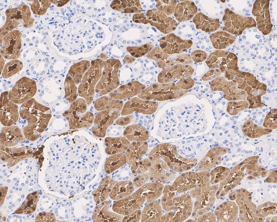 Immunohistochemistry: Aminoacylase/ACY1 Antibody (15G2-R) [NBP3-32000] - Immunohistochemical analysis of paraffin-embedded human kidney tissue with Mouse anti-Aminoacylase/ACY1 antibody (NBP3-32000) at 1/2,000 dilution. The section was pre-treated using heat mediated antigen retrieval with Tris-EDTA buffer (pH 9.0) for 20 minutes. The tissues were blocked in 1% BSA for 20 minutes at room temperature, washed with ddH2O and PBS, and then probed with the primary antibody (NBP3-32000) at 1/2,000 dilution for 1 hour at room temperature. The detection was performed using an HRP conjugated compact polymer system. DAB was used as the chromogen. Tissues were counterstained with hematoxylin and mounted with DPX.