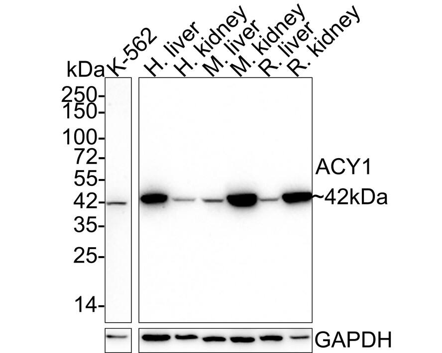 Western Blot: Aminoacylase/ACY1 Antibody (15G2-R) [NBP3-32000] - Western blot analysis of Aminoacylase/ACY1 on different lysates with Mouse anti-Aminoacylase/ACY1 antibody (NBP3-32000) at 1/1,000 dilution. Lane 1: K-562 cell lysate (20 ug/Lane) Lane 2: Human liver tissue lysate (40 ug/Lane) Lane 3: Human kidney tissue lysate (40 ug/Lane) Lane 4: Mouse liver tissue lysate (40 ug/Lane) Lane 5: Mouse kidney tissue lysate (40 ug/Lane) Lane 6: Rat liver tissue lysate (40 ug/Lane) Lane 7: Rat kidney tissue lysate (40 ug/Lane) Predicted band size: 46 kDa Observed band size: 42 kDa Exposure time: 3 minutes; 4-20% SDS-PAGE gel. Proteins were transferred to a PVDF membrane and blocked with 5% NFDM/TBST for 1 hour at room temperature. The primary antibody (NBP3-32000) at 1/1,000 dilution was used in 5% NFDM/TBST at 4℃ overnight. Goat Anti-Mouse IgG - HRP Secondary Antibody at 1/50,000 dilution was used for 1 hour at room temperature.