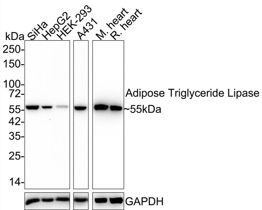 Western blot analysis on different lysates with NBP3-32004 at 1/1,000 dilution. Lane 1: SiHa cell lysate (30 µg/Lane) Lane 2: HepG2 cell lysate (30 µg/Lane) Lane 3: HEK-293 cell lysate (30 µg/Lane) Lane 4: A431 cell lysate (30 µg/Lane) Lane 5: Mouse heart tissue lysate (40 µg/Lane) Lane 6: Rat heart tissue lysate (40 µg/Lane) Predicted band size: 55 kDa Observed band size: 55 kDa Exposure time: Lane 1-4: 3 minutes; Lane 5-6: 5 seconds;  4-20% SDS-PAGE gel. Proteins were transferred to a PVDF membrane and blocked with 5% NFDM/TBST for 1 hour at room temperature. NBP3-32004 at 1/1,000 dilution was used in 5% NFDM/TBST at 4℃ overnight. Goat Anti-Rabbit IgG [HRP] Secondary Antibody at 1/50,000 dilution was used for 1 hour at room temperature.