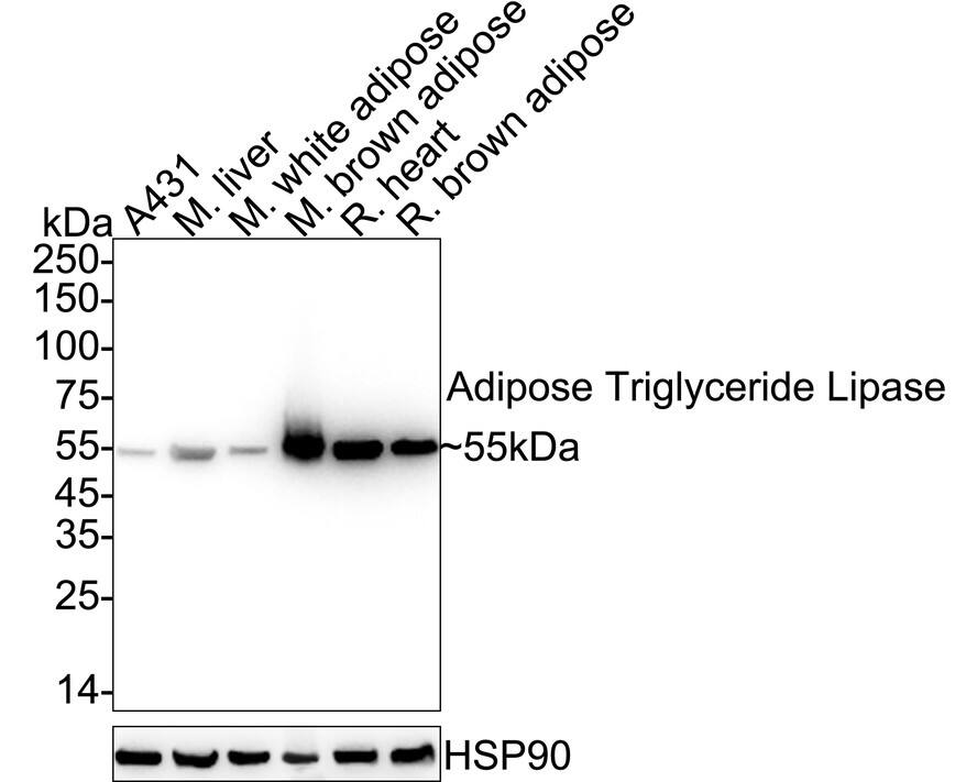 Western blot analysis on different lysates with NBP3-32004 at 1/1,000 dilution. Lane 1: A431 cell lysate (30 µg/Lane) Lane 2: Mouse liver tissue lysate (40 µg/Lane) Lane 3: Mouse white adipose tissue lysate (40 µg/Lane) Lane 4: Mouse brown adipose tissue lysate (40 µg/Lane) Lane 5: Rat heart tissue lysate (40 µg/Lane) Lane 6: Rat brown adipose tissue lysate (40 µg/Lane) Predicted band size: 55 kDa Observed band size: 55 kDa Exposure time: 10 seconds;  4-20% SDS-PAGE gel. Proteins were transferred to a PVDF membrane and blocked with 5% NFDM/TBST for 1 hour at room temperature. NBP3-32004 at 1/1,000 dilution was used in 5% NFDM/TBST at 4℃ overnight. Goat Anti-Rabbit IgG [HRP] Secondary Antibody at 1/50,000 dilution was used for 1 hour at room temperature.