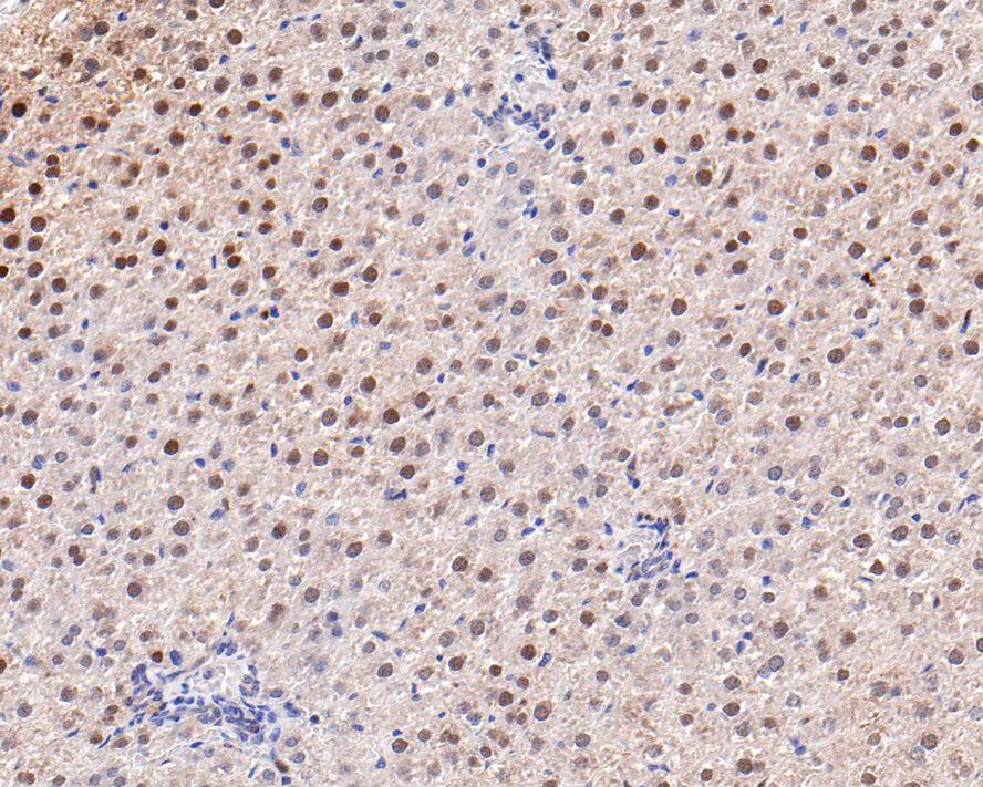 Immunohistochemistry: Adenylosuccinate Synthase Antibody (JE64-42) [NBP3-32005] - Immunohistochemical analysis of paraffin-embedded rat liver tissue with Rabbit anti-Adenylosuccinate Synthase antibody (NBP3-32005) at 1/100 dilution. The section was pre-treated using heat mediated antigen retrieval with Tris-EDTA buffer (pH 9.0) for 20 minutes. The tissues were blocked in 1% BSA for 20 minutes at room temperature, washed with ddH2O and PBS, and then probed with the primary antibody (NBP3-32005) at 1/100 dilution for 1 hour at room temperature. The detection was performed using an HRP conjugated compact polymer system. DAB was used as the chromogen. Tissues were counterstained with hematoxylin and mounted with DPX.