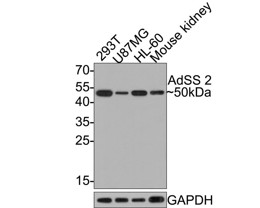 Western Blot: Adenylosuccinate Synthase Antibody (JE64-42) [NBP3-32005] - Western blot analysis of Adenylosuccinate Synthase on different lysates with Rabbit anti-Adenylosuccinate Synthase antibody (NBP3-32005) at 1/500 dilution. Lane 1: 293T cell lysate Lane 2: U87MG cell lysate Lane 3: HL-60 cell lysate Lane 4: Mouse kidney tissue lysate (20 ug/Lane) Lysates/proteins at 10 ug/Lane. Predicted band size: 50 kDa Observed band size: 50 kDa Exposure time: 2 minutes; 12% SDS-PAGE gel. Proteins were transferred to a PVDF membrane and blocked with 5% NFDM/TBST for 1 hour at room temperature. The primary antibody (NBP3-32005) at 1/500 dilution was used in 5% NFDM/TBST at room temperature for 2 hours. Goat Anti-Rabbit IgG - HRP Secondary Antibody at 1:300,000 dilution was used for 1 hour at room temperature.