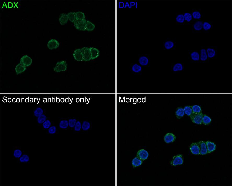 Immunocytochemistry/ Immunofluorescence: FDX1 Antibody (JE63-56) [NBP3-32006] - Immunocytochemistry analysis of PC-12 cells labeling FDX1 with Rabbit anti-FDX1 antibody (NBP3-32006) at 1/50 dilution. Cells were fixed in 4% paraformaldehyde for 10 minutes at 37 ℃, permeabilized with 0.05% Triton X-100 in PBS for 20 minutes, and then blocked with 2% negative goat serum for 30 minutes at room temperature. Cells were then incubated with Rabbit anti-FDX1 antibody (NBP3-32006) at 1/50 dilution in 2% negative goat serum overnight at 4 ℃. Goat Anti-Rabbit IgG H&L (iFluor™ 488) was used as the secondary antibody at 1/1,000 dilution. PBS instead of the primary antibody was used as the secondary antibody only control. Nuclear DNA was labelled in blue with DAPI.