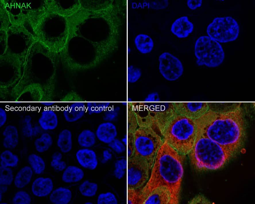 Immunocytochemistry/ Immunofluorescence: AHNAK Antibody (PSH01-11) [NBP3-32010] - Immunocytochemistry analysis of A431 cells labeling AHNAK with Rabbit anti-AHNAK antibody (NBP3-32010) at 1/100 dilution. Cells were fixed in 4% paraformaldehyde for 20 minutes at room temperature, permeabilized with 0.1% Triton X-100 in PBS for 5 minutes at room temperature, then blocked with 1% BSA in 10% negative goat serum for 1 hour at room temperature. Cells were then incubated with Rabbit anti-AHNAK antibody (NBP3-32010) at 1/100 dilution in 1% BSA in PBST overnight at 4 ℃. Goat Anti-Rabbit IgG H&L (iFluor™ 488) was used as the secondary antibody at 1/1,000 dilution. PBS instead of the primary antibody was used as the secondary antibody only control. Nuclear DNA was labelled in blue with DAPI. Beta tubulin (red) was stained at 1/100 dilution overnight at +4℃. Goat Anti-Mouse IgG H&L (iFluor™ 594) was used as the secondary antibody at 1/1,000 dilution.