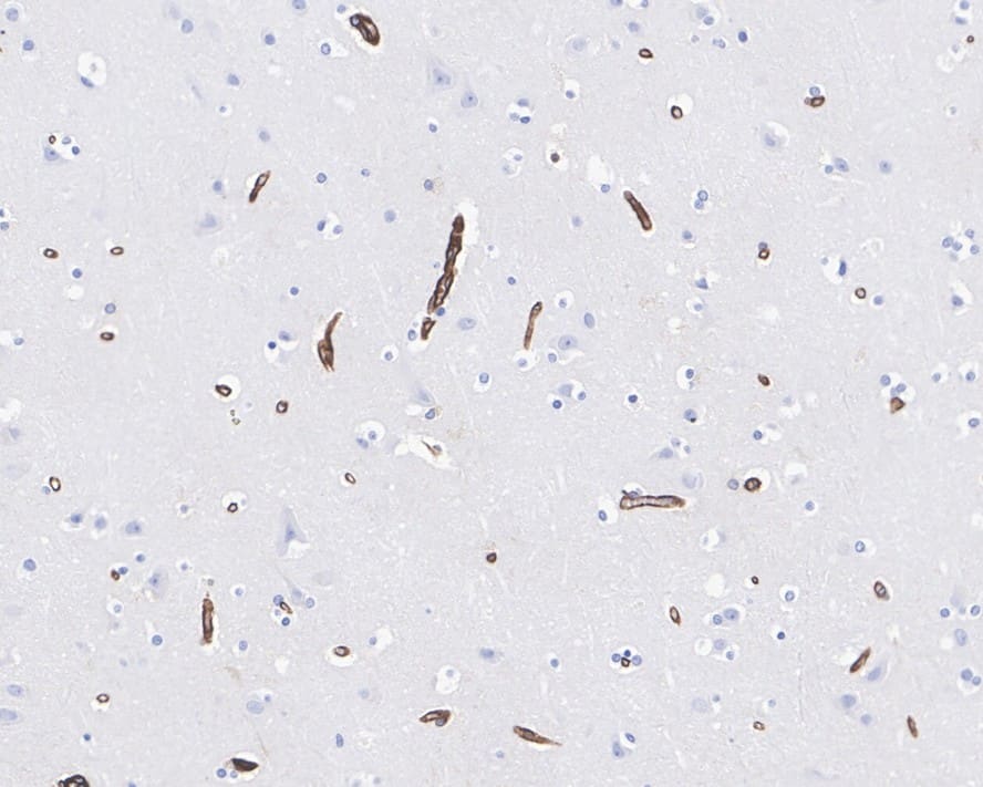 Immunohistochemistry: AHNAK Antibody (PSH01-11) [NBP3-32010] - Immunohistochemical analysis of paraffin-embedded human brain tissue with Rabbit anti-AHNAK antibody (NBP3-32010) at 1/1,000 dilution. The section was pre-treated using heat mediated antigen retrieval with Tris-EDTA buffer (pH 9.0) for 20 minutes. The tissues were blocked in 1% BSA for 20 minutes at room temperature, washed with ddH2O and PBS, and then probed with the primary antibody (NBP3-32010) at 1/1,000 dilution for 1 hour at room temperature. The detection was performed using an HRP conjugated compact polymer system. DAB was used as the chromogen. Tissues were counterstained with hematoxylin and mounted with DPX.