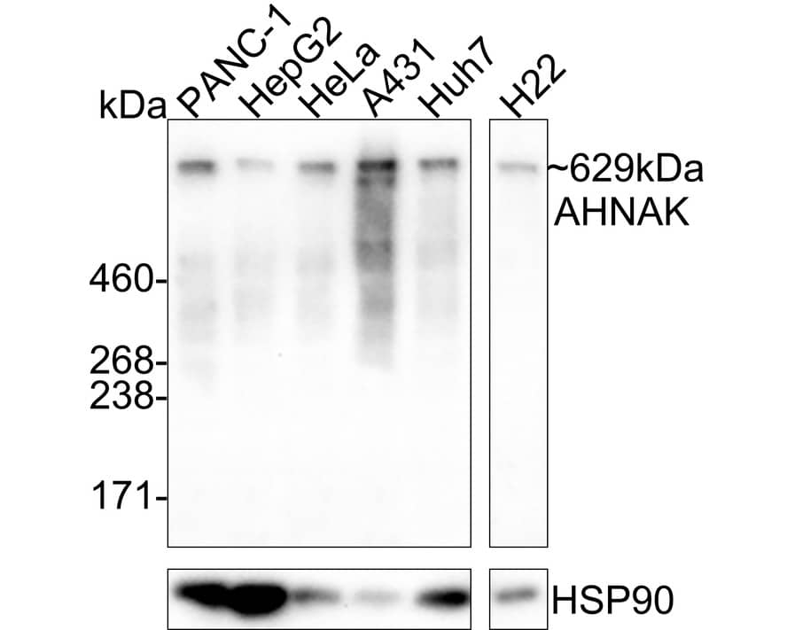 Western Blot: AHNAK Antibody (PSH01-11) [NBP3-32010] - Western blot analysis of AHNAK on different lysates with Rabbit anti-AHNAK antibody (NBP3-32010) at 1/1,000 dilution. Lane 1: PANC-1 cell lysate Lane 2: HepG2 cell lysate Lane 3: HeLa cell lysate Lane 4: A431 cell lysate Lane 5: Huh7 cell lysate Lane 6: H22 cell lysate Lysates/proteins at 50 ug/Lane. Predicted band size: 629 kDa Observed band size: 629 kDa Exposure time: 2 minutes; 3-8% SDS-PAGE gel. Proteins were transferred to a PVDF membrane and blocked with 5% NFDM/TBST for 1 hour at room temperature. The primary antibody (NBP3-32010) at 1/1,000 dilution was used in 5% NFDM/TBST at 4℃ overnight. Goat Anti-Rabbit IgG - HRP Secondary Antibody at 1:50,000 dilution was used for 1 hour at room temperature.