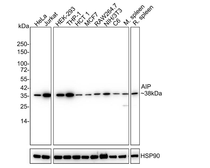 Western Blot AIP/ARA9 Antibody (PSH03-17)